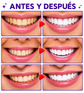 Blanqueador Dental PURPLE WHITENING